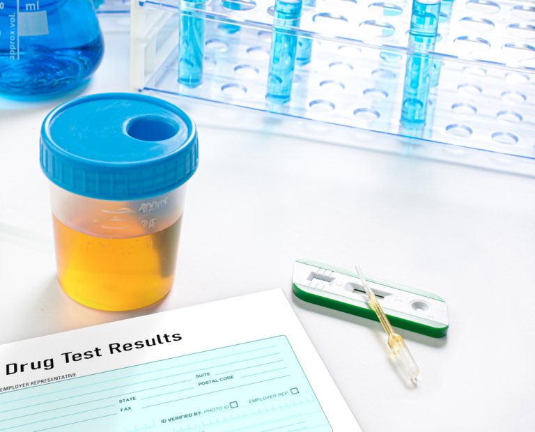 Does a Background Check Include a Drug Test?